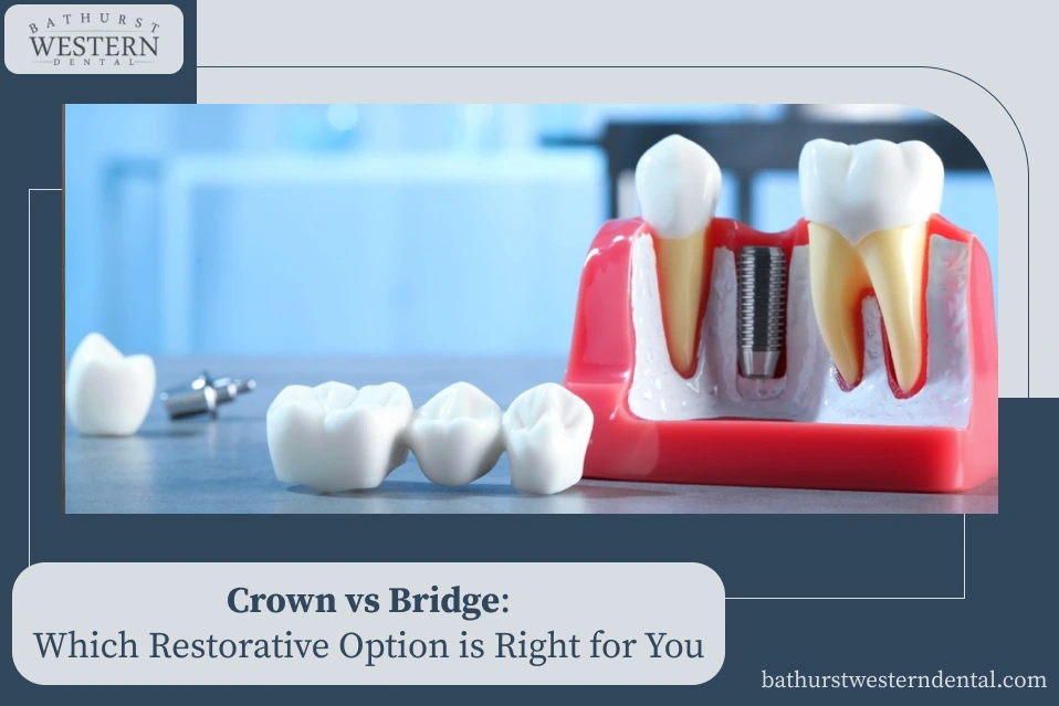 Crown vs Bridge: Which Restorative Option Is Right for You